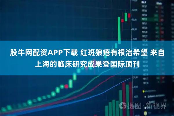 股牛网配资APP下载 红斑狼疮有根治希望 来自上海的临床研究成果登国际顶刊